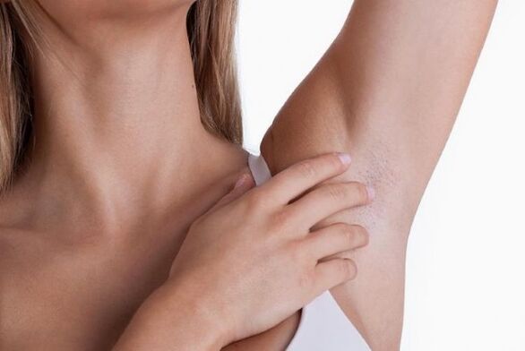 papillomas under a woman's armpit