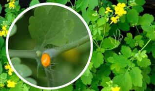 How celandine is used for papillomas